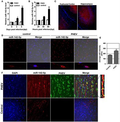 miR-142-5p Disrupts Neuronal Morphogenesis Underlying Porcine Hemagglutinating Encephalomyelitis Virus Infection by Targeting Ulk1